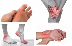 GC GoutCare product scene focused on uric acid support and daily routine