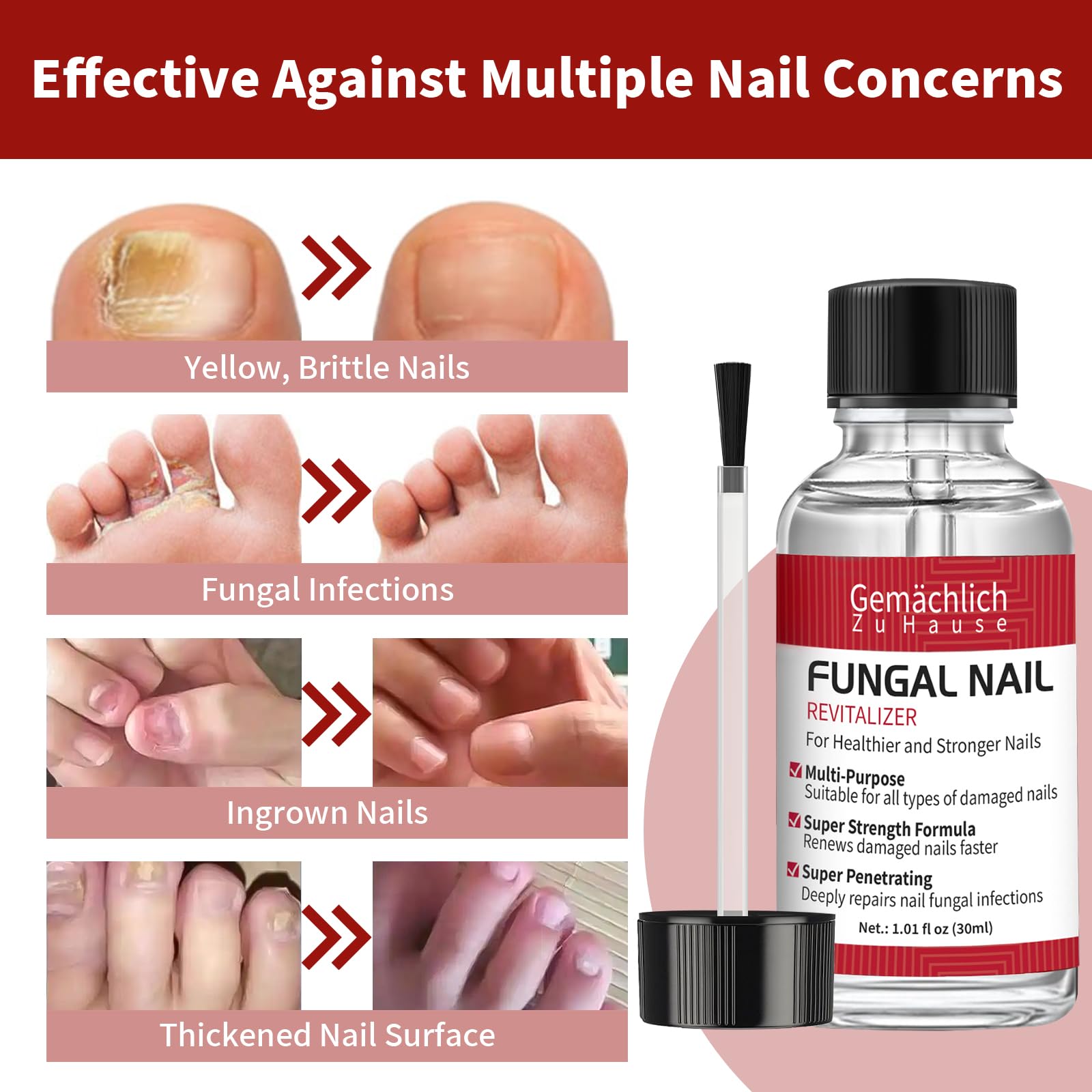 Gemächlich ZuHause applying treatment on nail shows targeted, easy application.