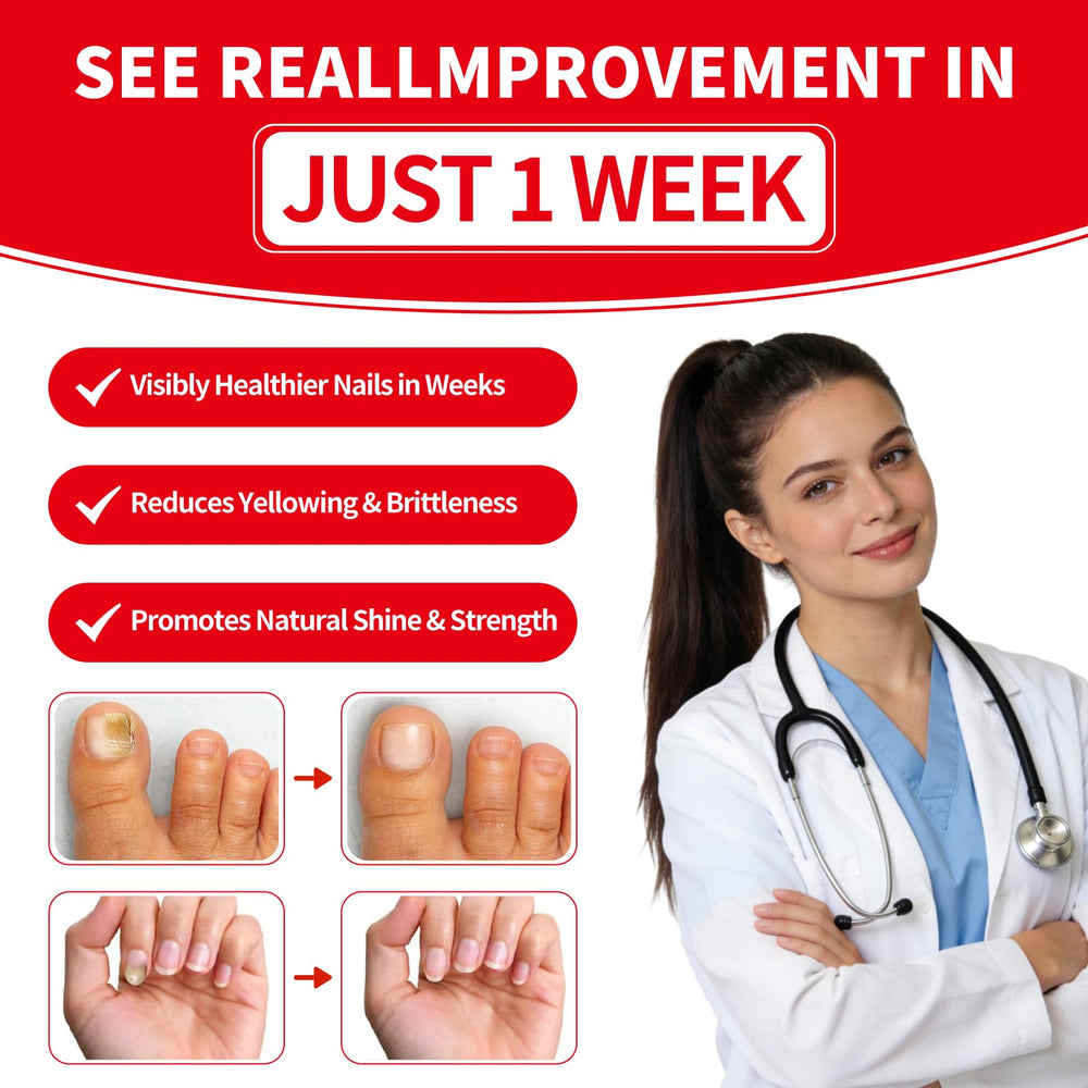 Gemächlich ZuHause before-and-after nails show clearer, healthier-looking nails.