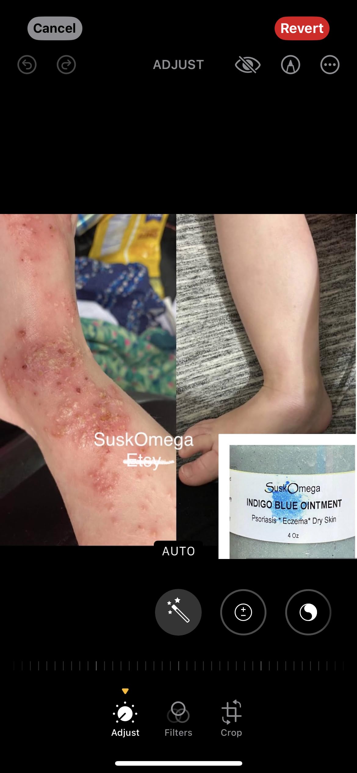 Generic Indigo Blue Ointment 8oz in use during first aid scenario
