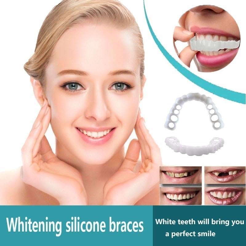 Generic natural-smile-veneer-look suited for everyday wear.