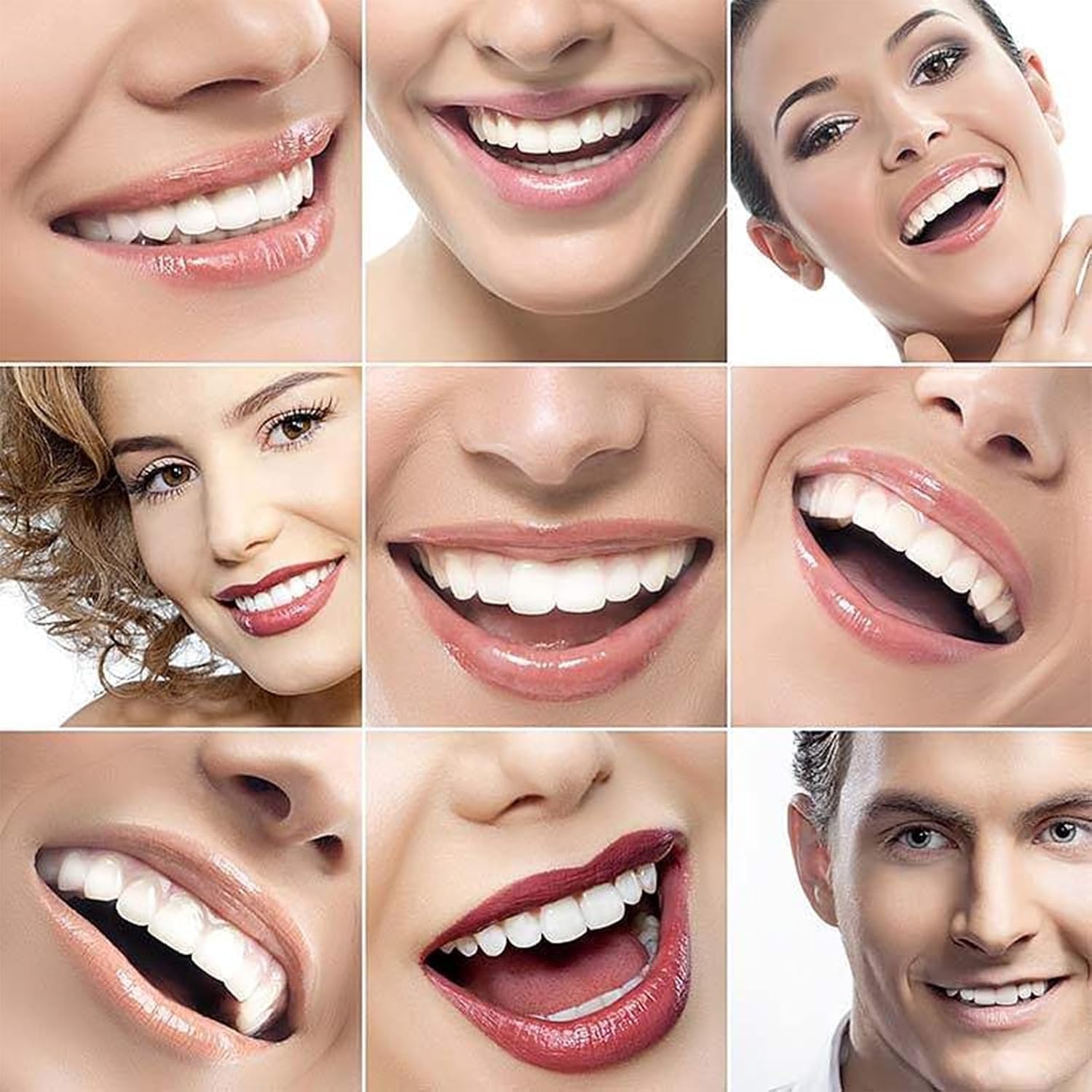 Generic shiny smile veneers close-up for natural look.