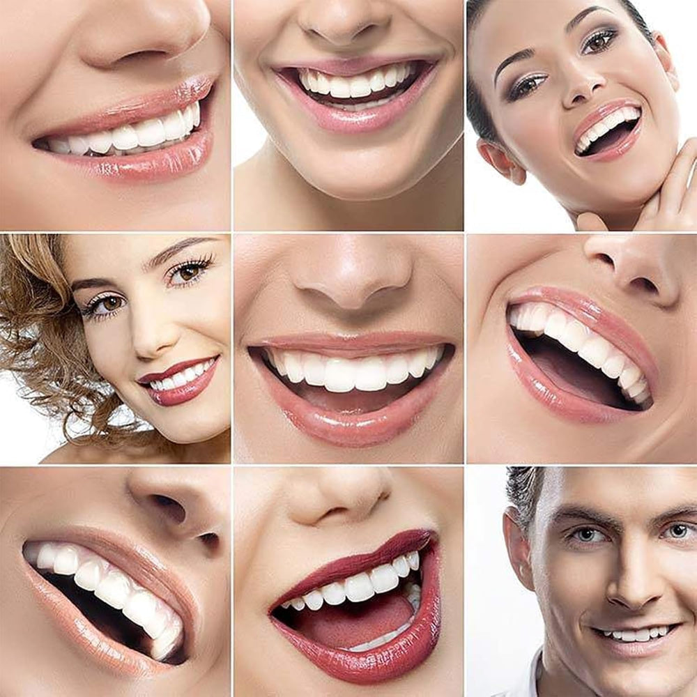 Generic shiny smile veneers close-up for natural look.