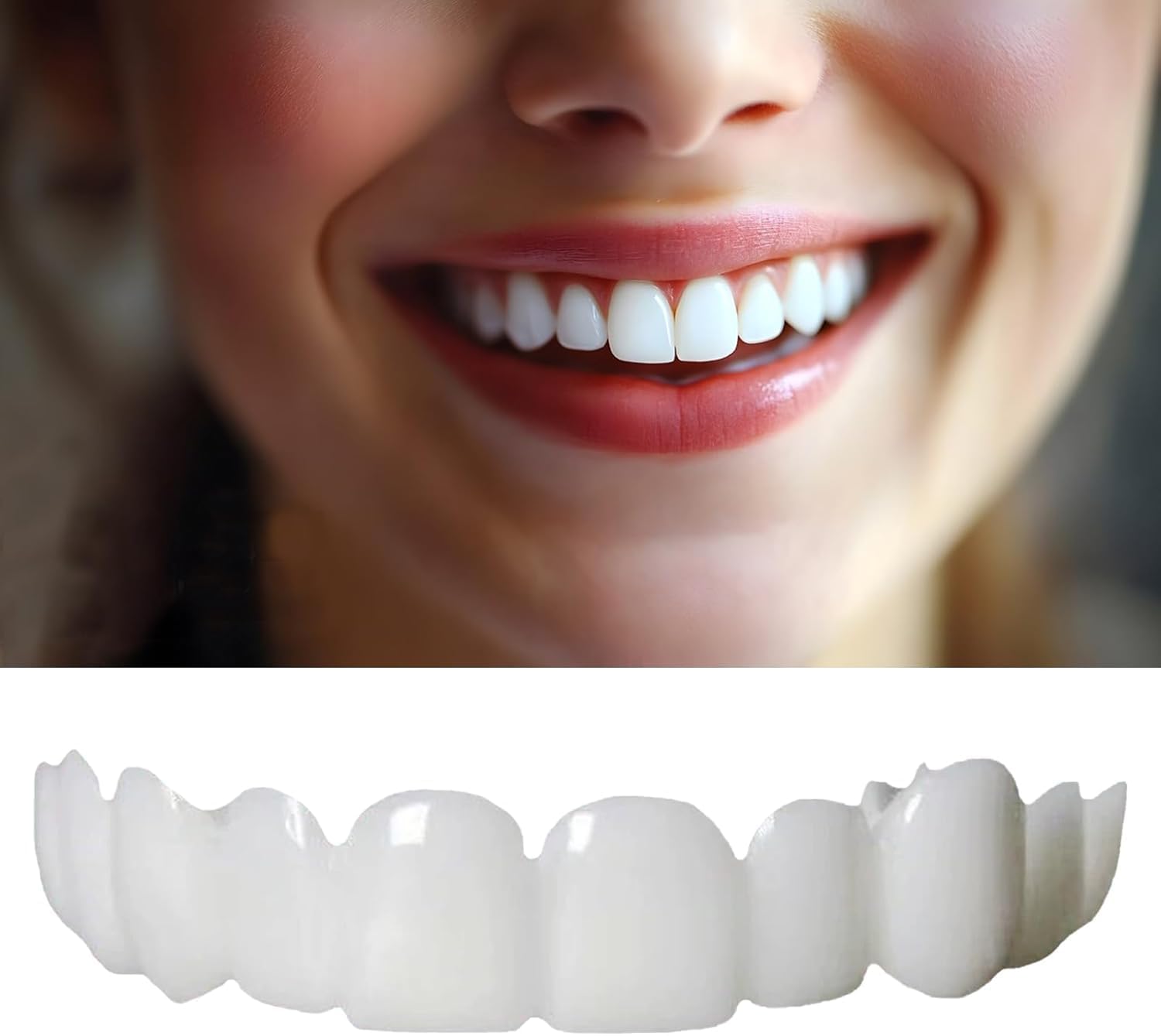 Generic veneers on a woman's smile for wedding-ready confidence.