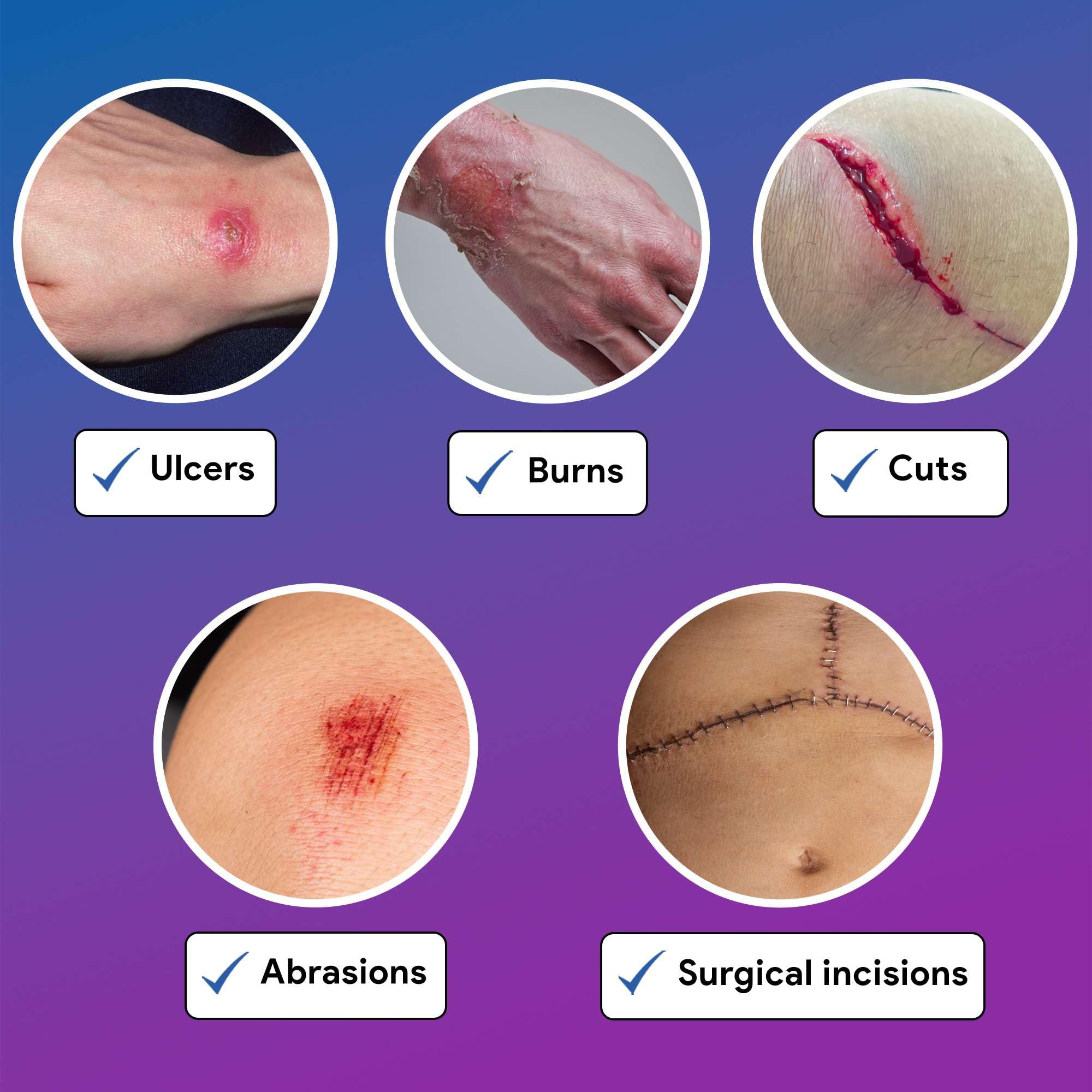 Open box reveals 10 sterile dressings from Gentell Select.