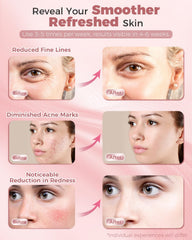 Glamesty mask soft silicone material for gentle sessions