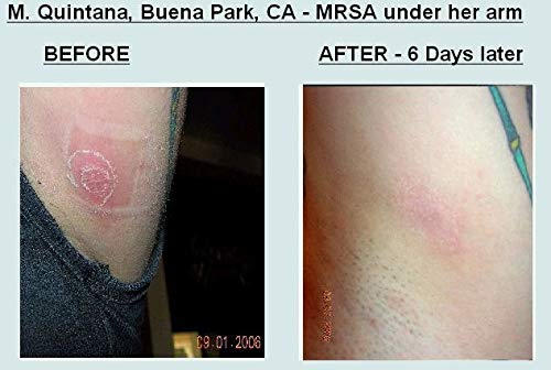 Grandma's Pine Tar Salve used by people and pets for skin care and minor irritations.
