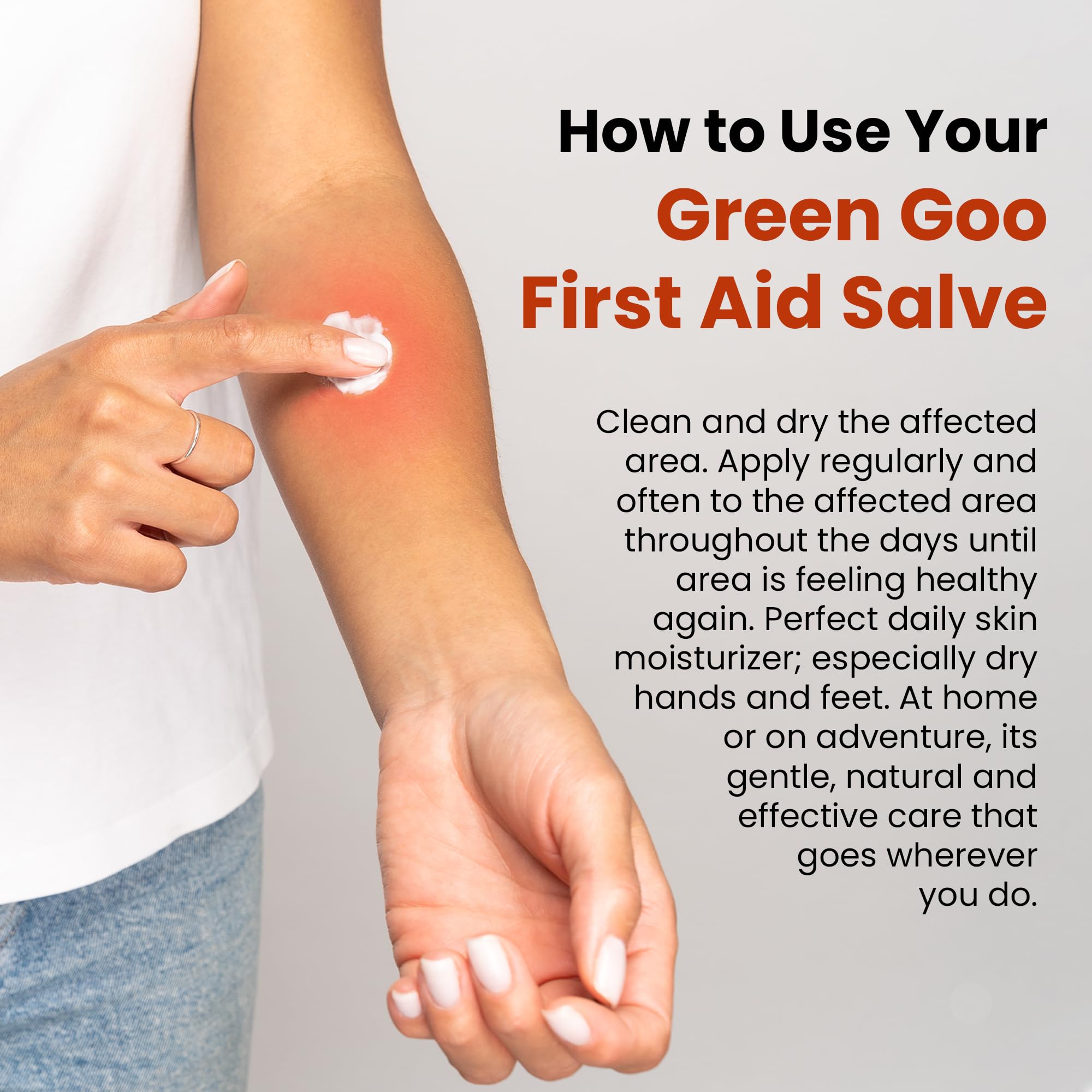 Green Goo on hand demonstrates portable, travel-friendly first aid.
