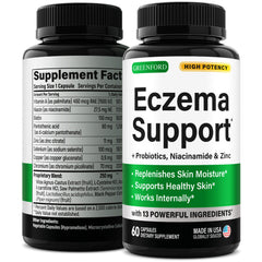 Greenford Eczema Support bottle front for daily skin wellness.