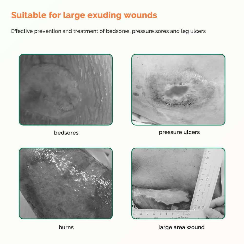 Greetmed sterile 10-pack sacral dressing suitable for various wound types and burns