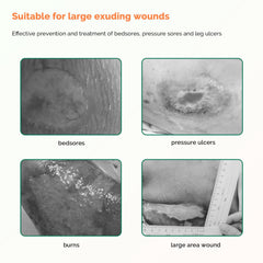 Greetmed sterile 10-pack sacral dressing suitable for various wound types and burns