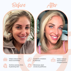 Groomie GlowUp mask with infrared light for a radiant, lively appearance.