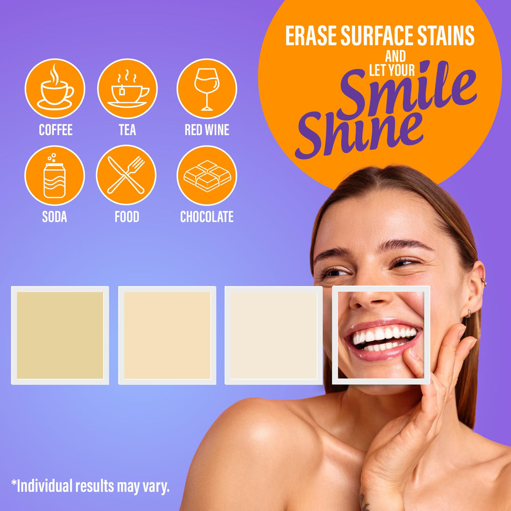 GuruNanda whitening gel application on teeth before LED session
