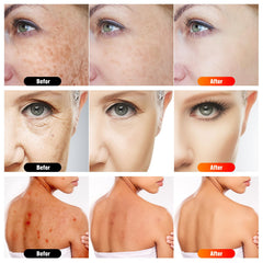 GYP compact treatment panel makes portable red light therapy simple.