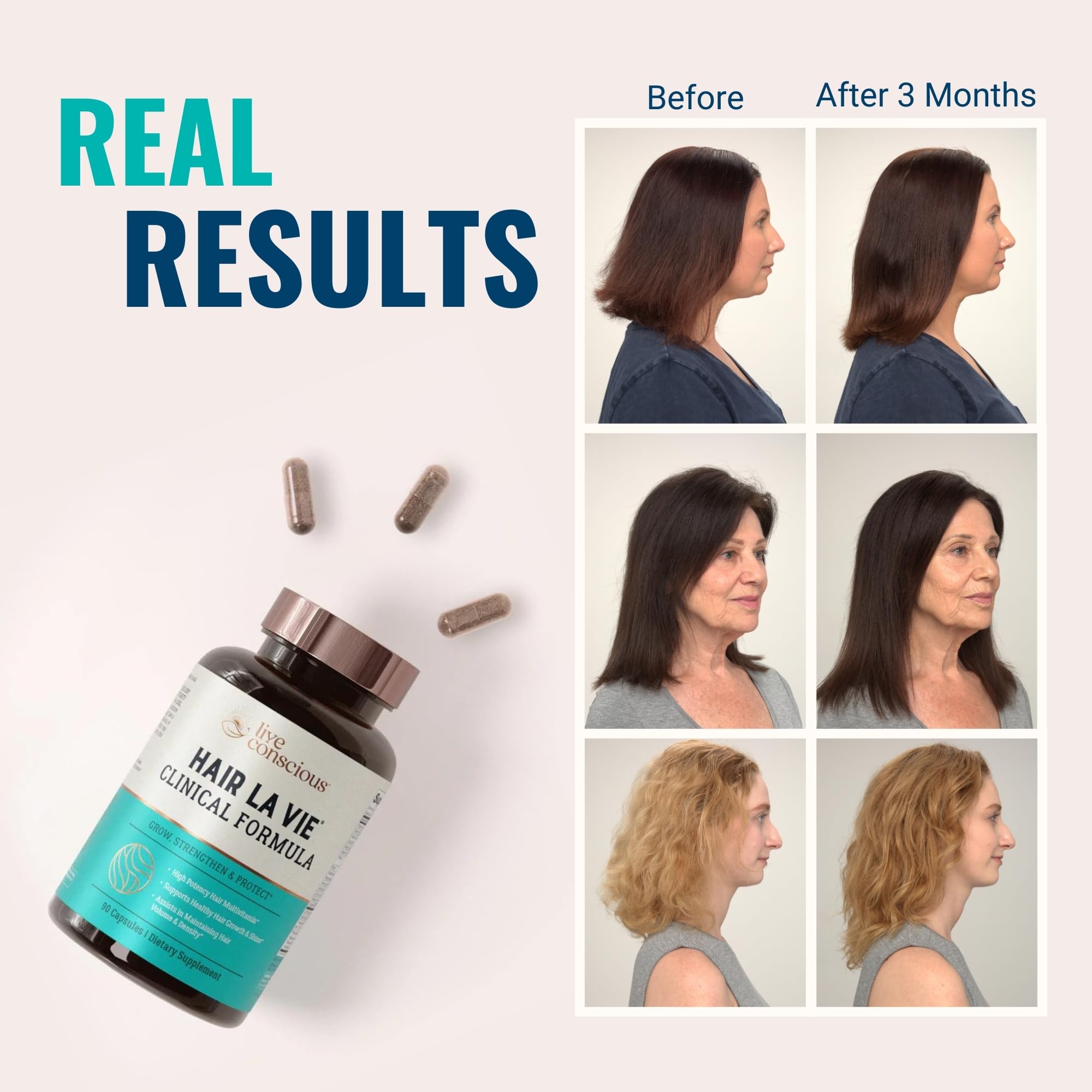 Hair La Vie pack front emphasizing daily hair support