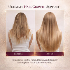 Hair Queen ferritin-support label highlights iron-focused nourishment.