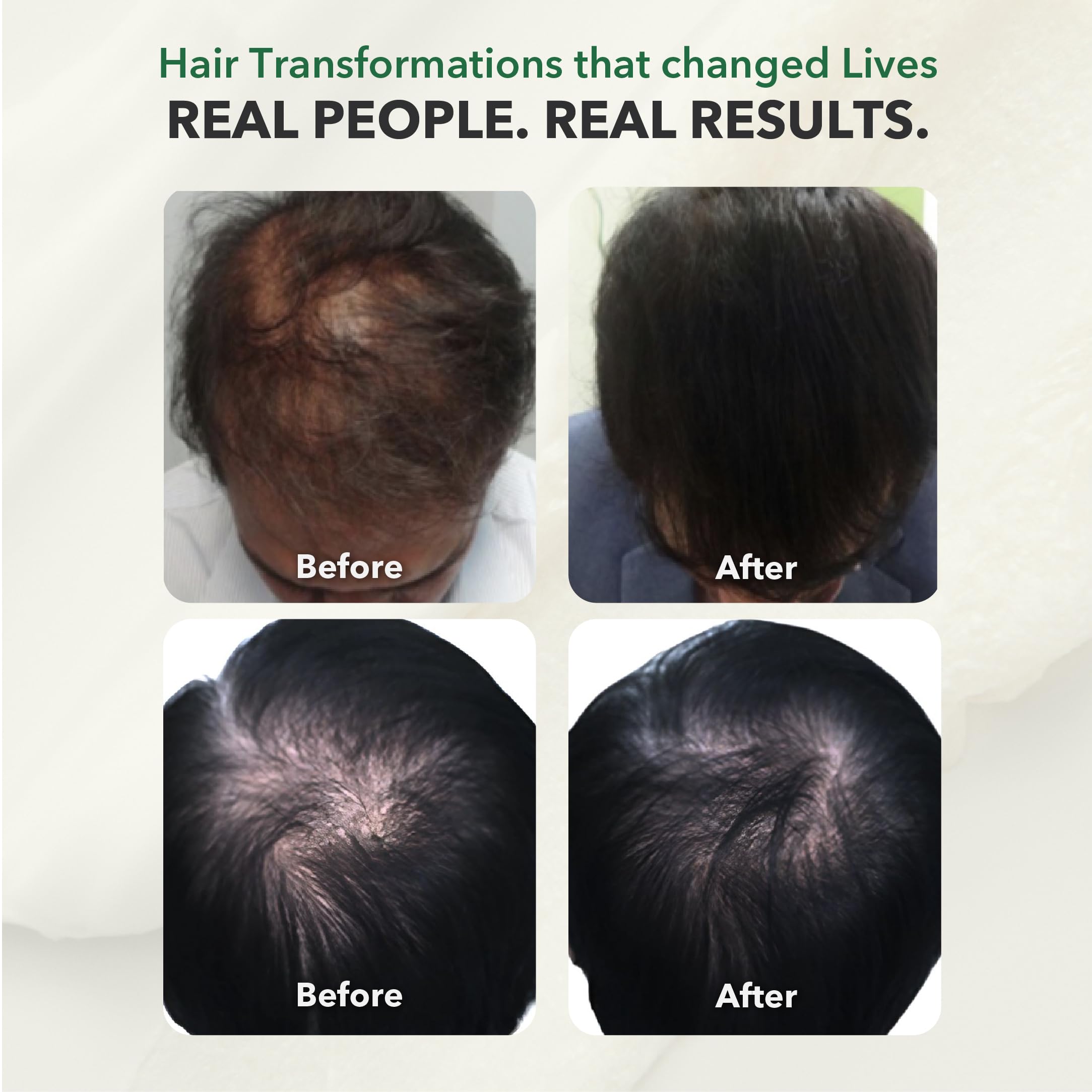 HairSmart DHT Blocker gluten-free icon reassures allergen-free formula.