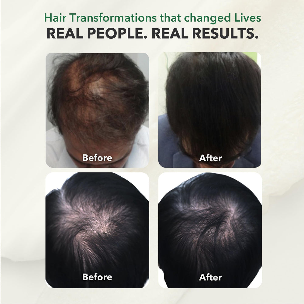 HairSmart DHT Blocker gluten-free icon reassures allergen-free formula.