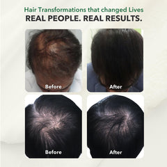 HairSmart DHT Blocker gluten-free icon reassures allergen-free formula.