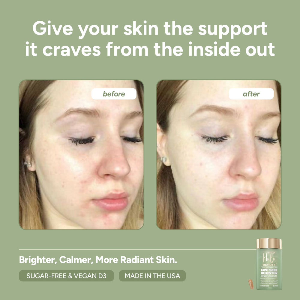 Halo Beauty Kiwi Seed Booster kiwi seeds close-up showing natural antioxidants for skin