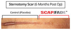 Hanson Silicone Scar Ointment cream texture appears smooth