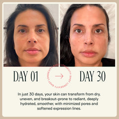 Happy Aging NAD+ shot twice-weekly use supports simple routine