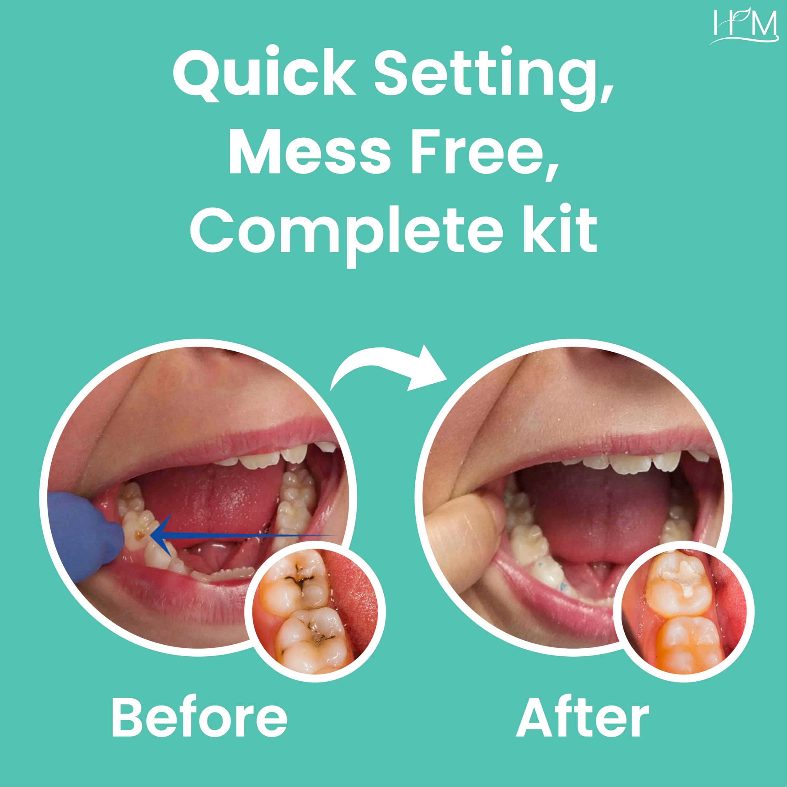 Happy Moms tweezers enable precise handling of small components during at-home dental care.