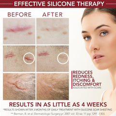 HealFast gel used on the body for versatile scar care