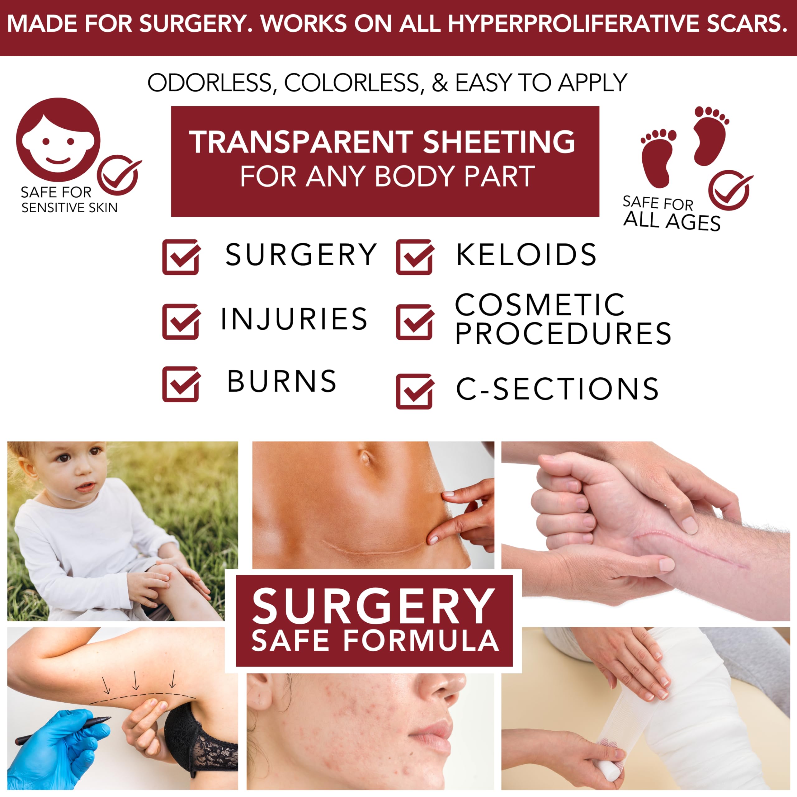 HealFast gel on post-surgical scar demonstrates treatment potential