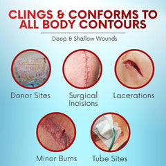 Healqu Xeroform breathable moisture environment supports comfortable healing.