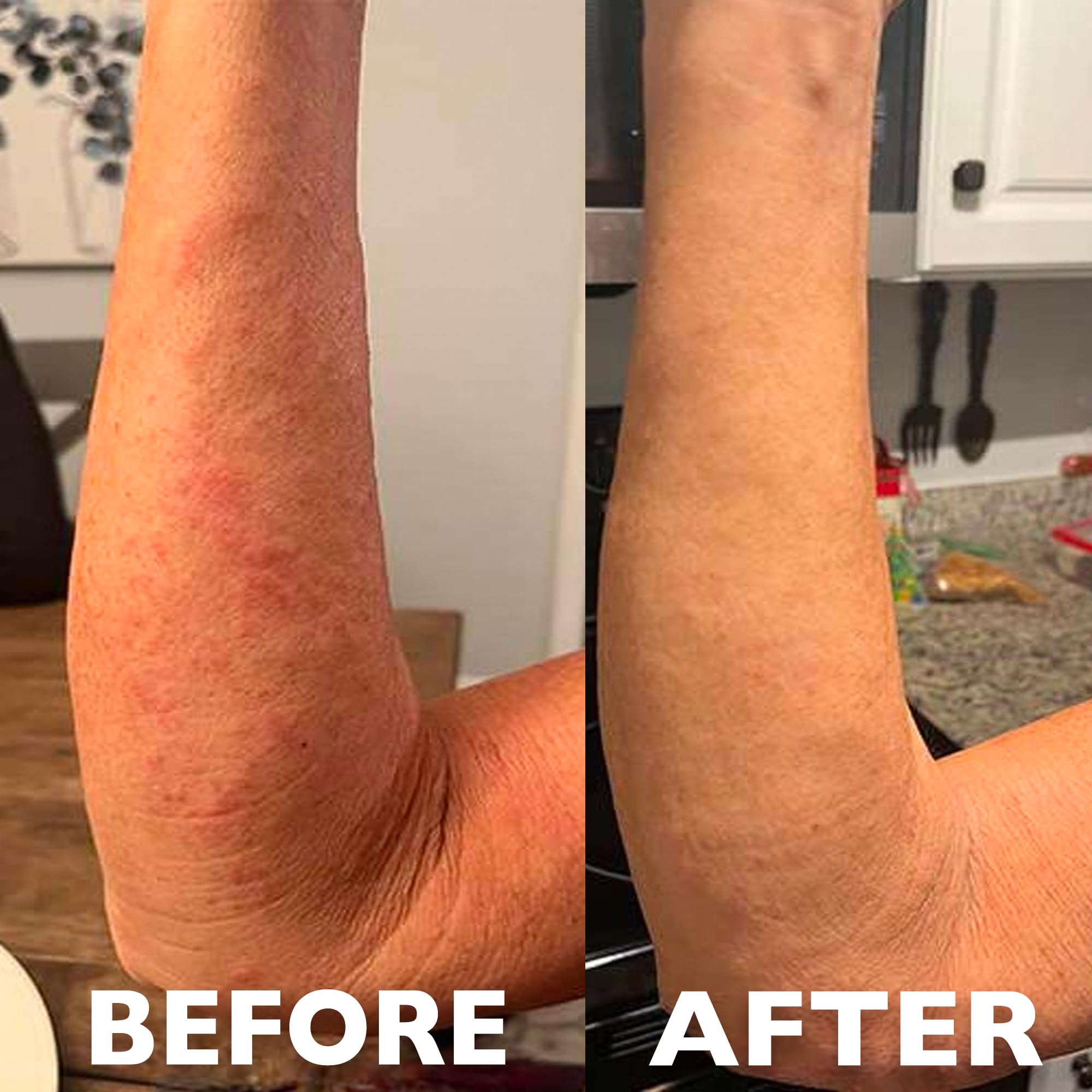 Hey Honey 911 Propolis Gel applied to skin for soothing relief