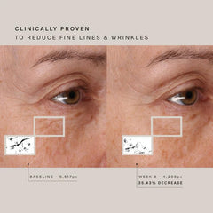 HigherDOSE red-light session at home promotes moisture and glow.