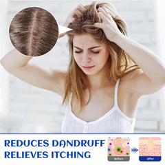 HIQILI rosemary oil used for body massage with gentle strokes