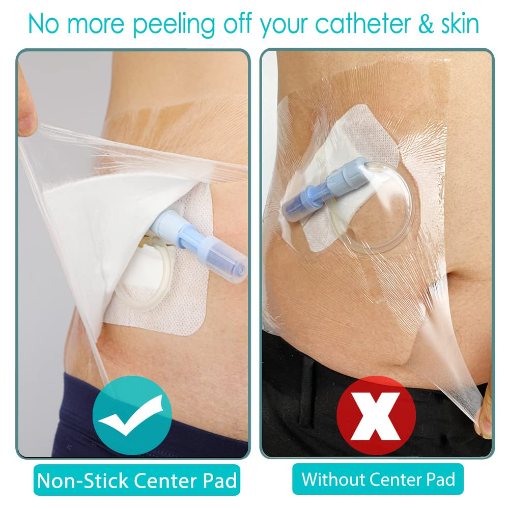 Hola Health G-tube shielding pad protects feeding tube during shower