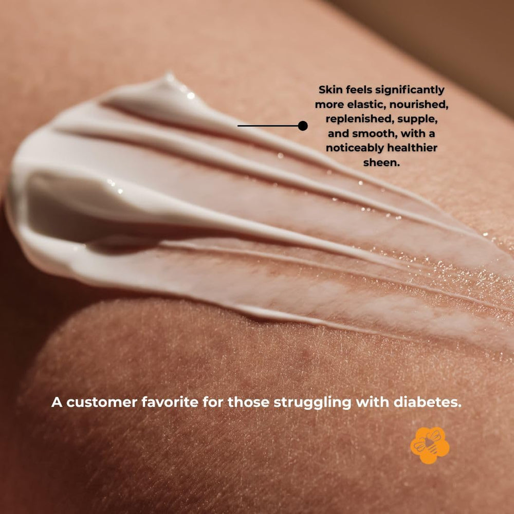 Hydration for hands, elbows, and feet with Honey for Healing.