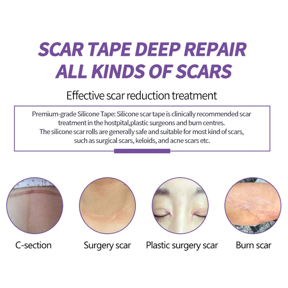 HPUFKOT burn scar care sheet provides gentle moisture and protection