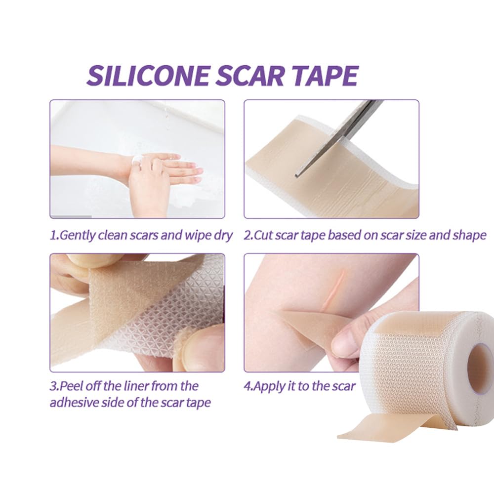 HPUFKOT keloid scar management sheet smooths raised scars
