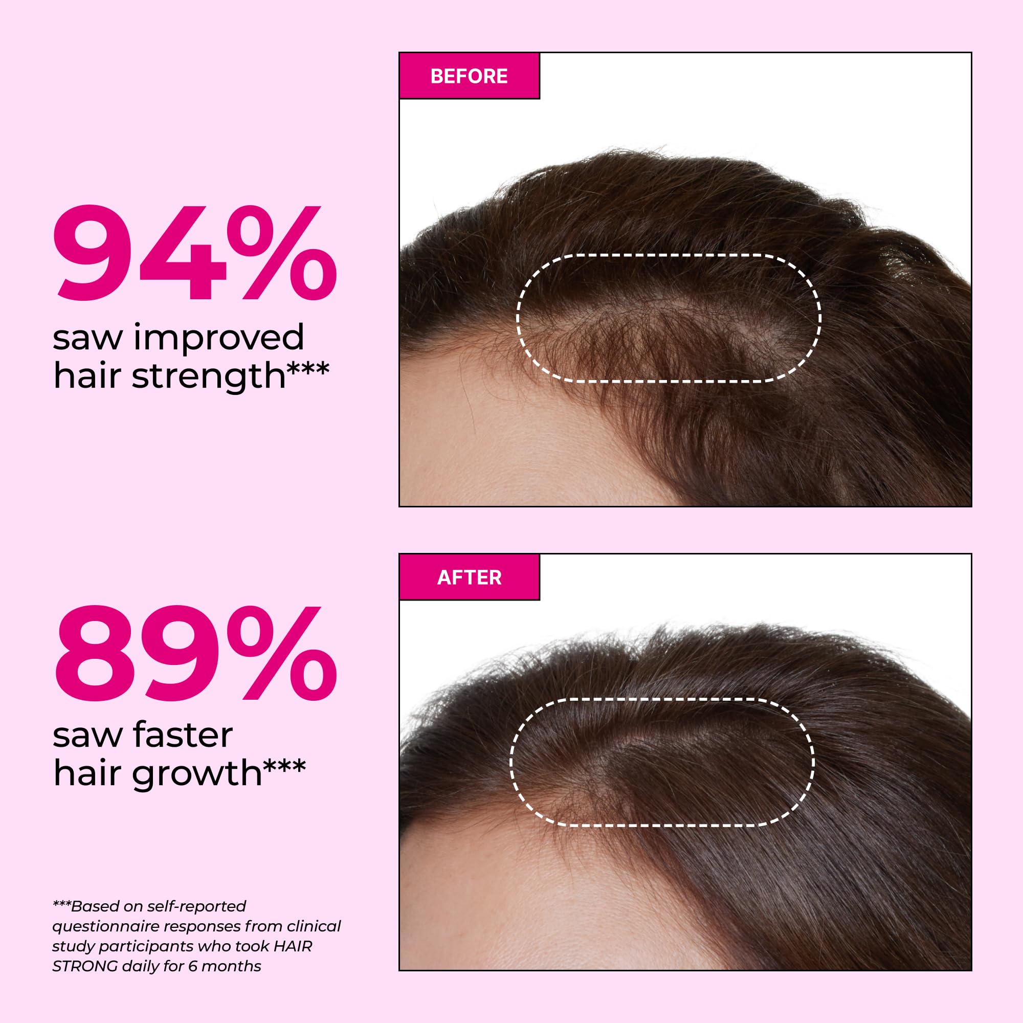 HUM Hair Strong Gummies closeup shows chewy texture ideal for a tasty routine.