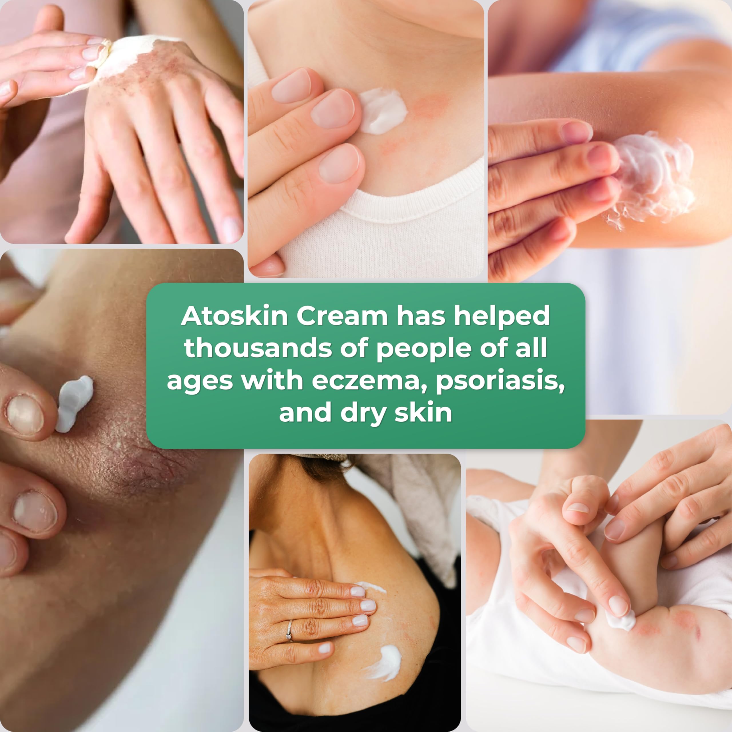 HVSun Atoskin eczema cream daily ritual promotes comfortable skin during flare-ups.