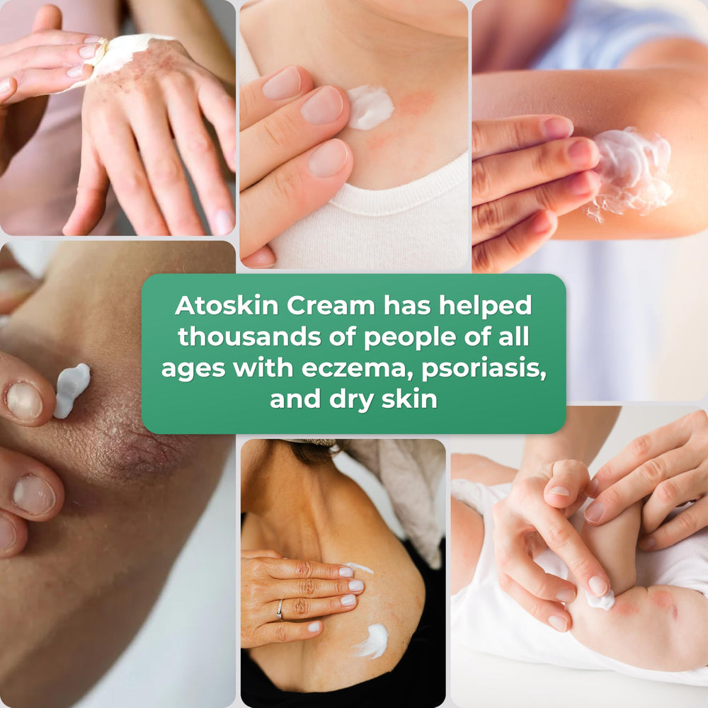HVSun Atoskin eczema cream daily ritual promotes comfortable skin during flare-ups.