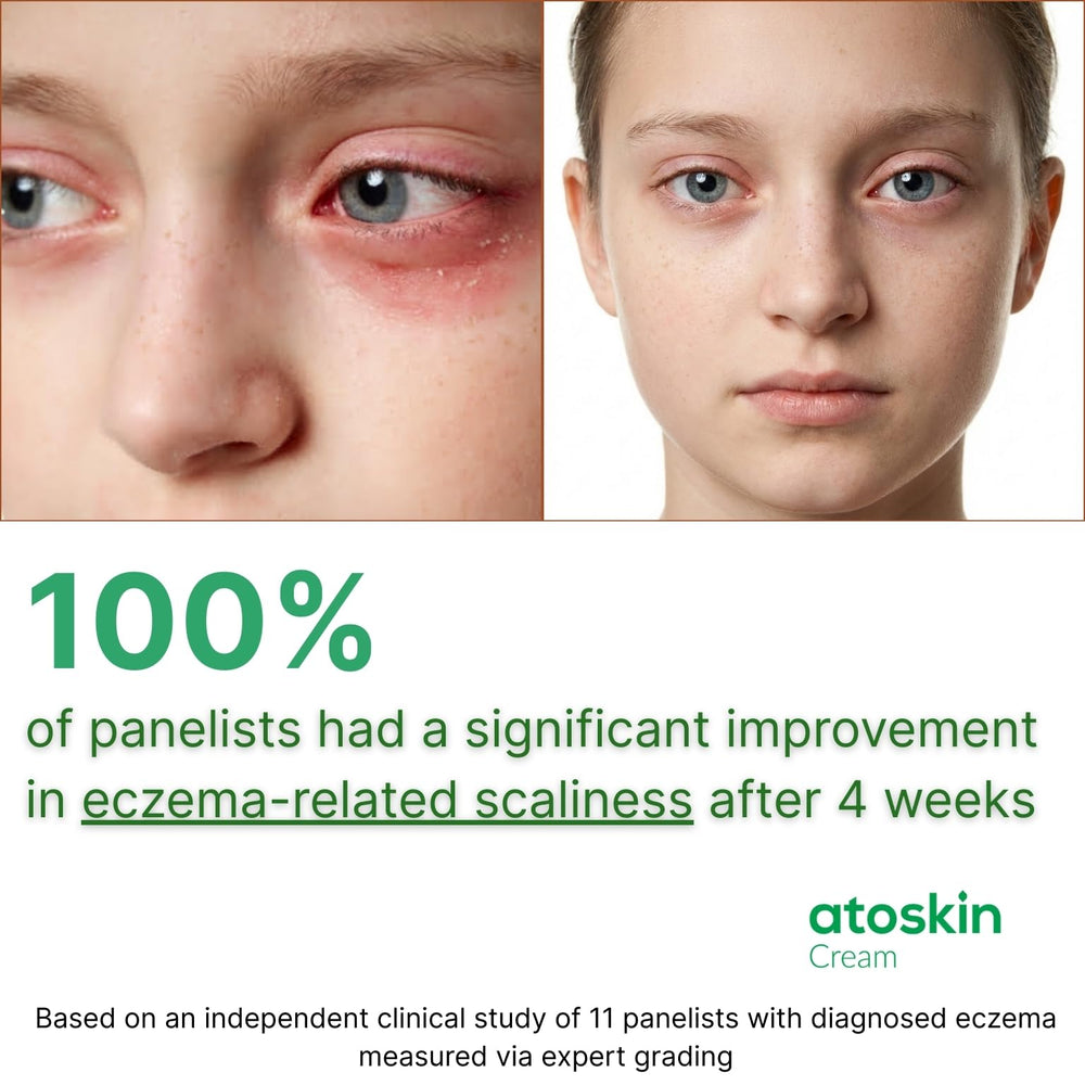 HVSun Atoskin eczema cream skin close-up reveals a rich, moisturizing formula.