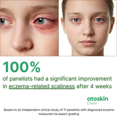 HVSun Atoskin eczema cream skin close-up reveals a rich, moisturizing formula.
