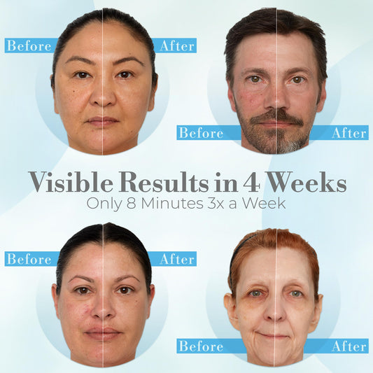 iderma 128-diode LED array provides consistent light therapy across the face