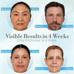 iderma 128-diode LED array provides consistent light therapy across the face