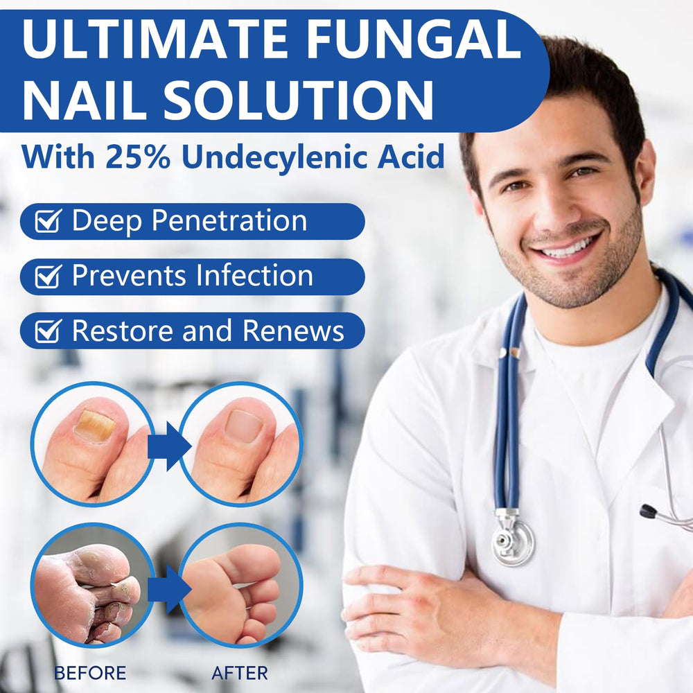 IFUNSHAR treatment liquid applied to the affected yellowing nail.