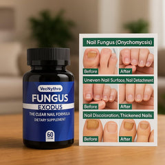 iKeener Fungus Exodus bottle side highlights daily capsule intake for foot wellness