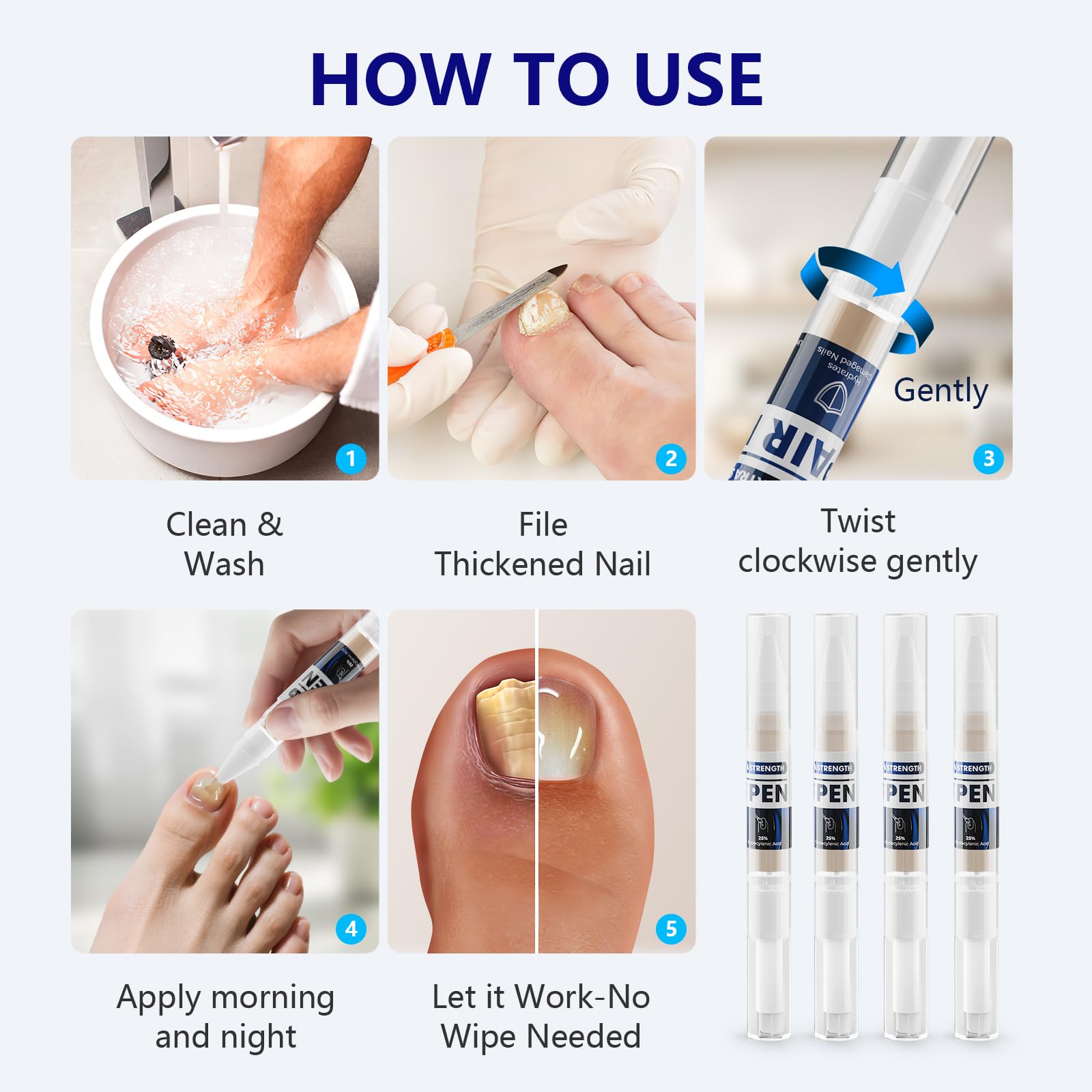 iKeener Toe Nail Fungus Pen contains 25% undecylenic acid for natural nail care.