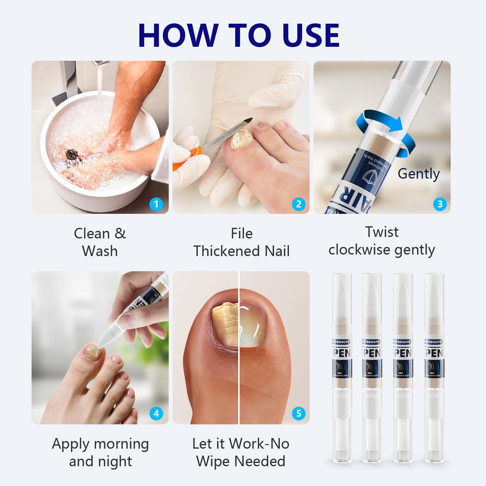 iKeener Toe Nail Fungus Pen contains 25% undecylenic acid for natural nail care.