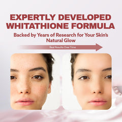 Korean science-backed ILO Whitathione formulation