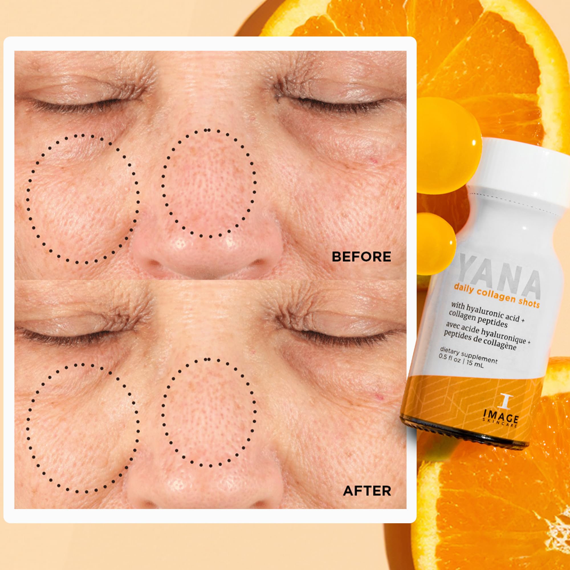 IMAGE Skincare YANA ingredients feature organic acai and pomegranate juices.